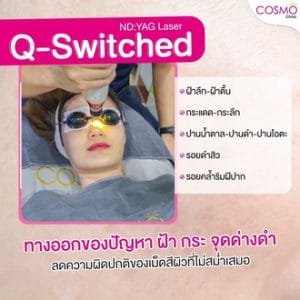 Qswitch review1