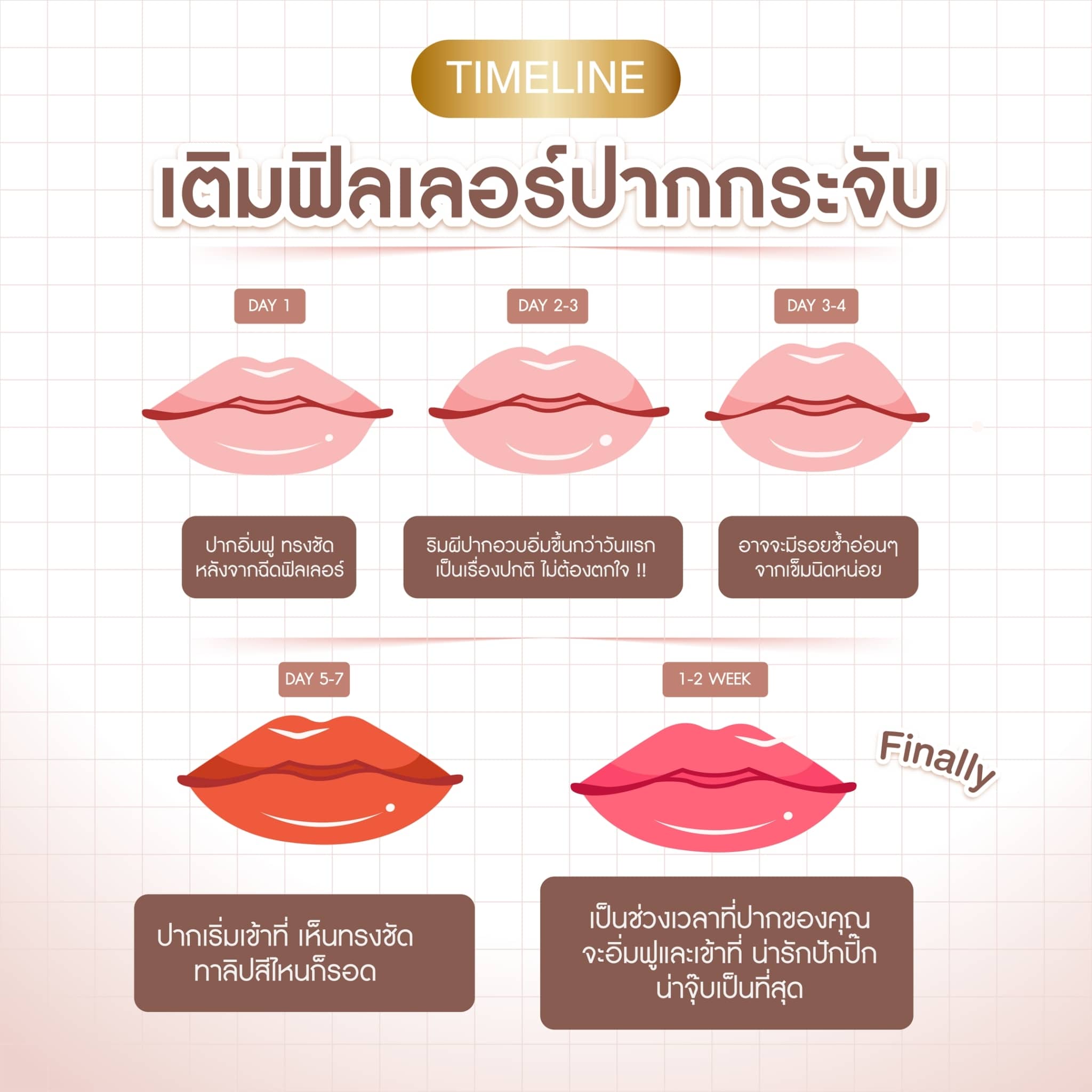 filler ปาก