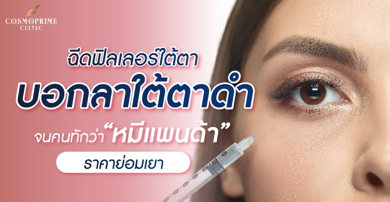 ฟิลเลอร์ใต้ตา