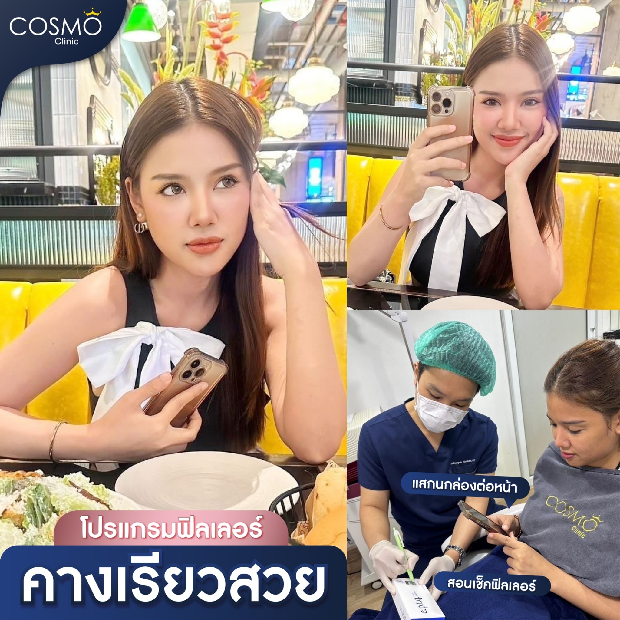 รีวิวฉีดคาง 1 cc