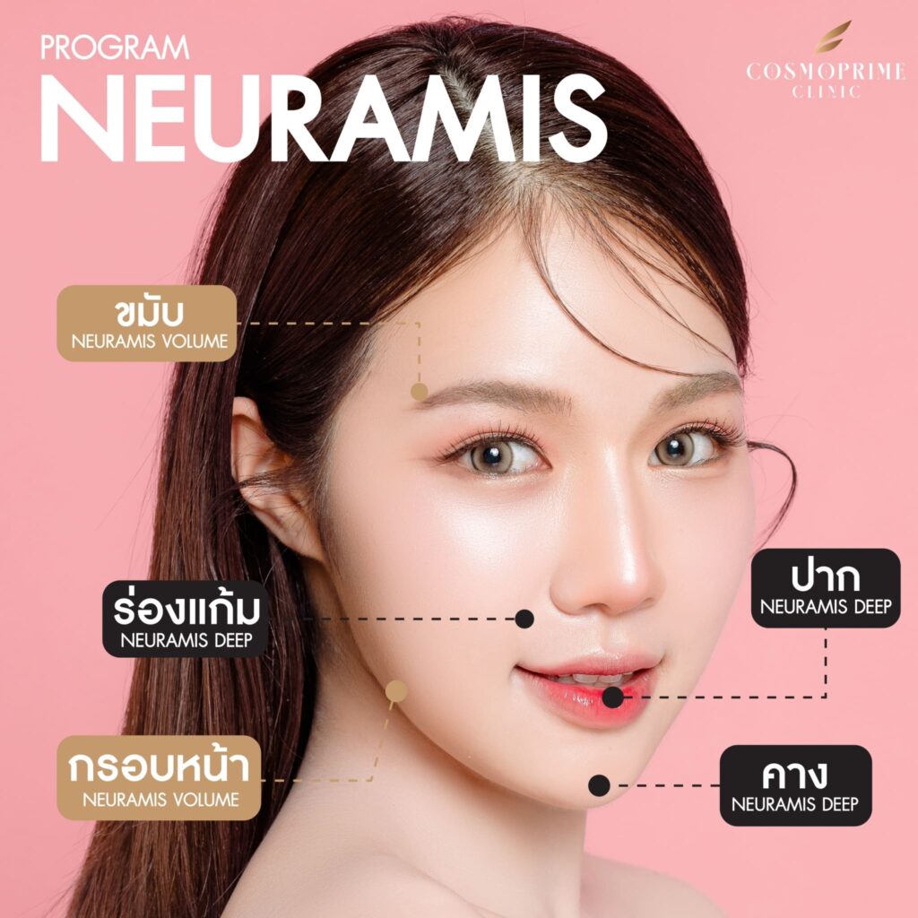 ฟิลเลอร์คาง neuramis