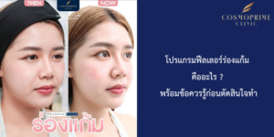 โปรแกรมฟีลเลอร์ร่องแก้ม