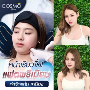 meso fatตัว