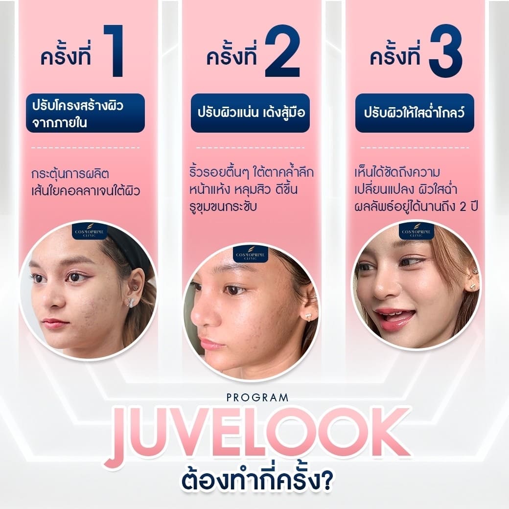 Juvelook ราคา