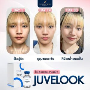 juvelook ฉีดตรงไหน