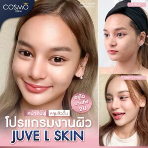 juvelook ใต้ตา ราคา