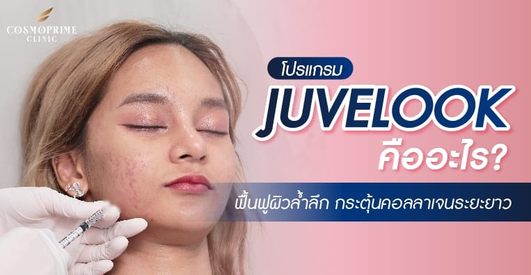 juvellook คืออะไร