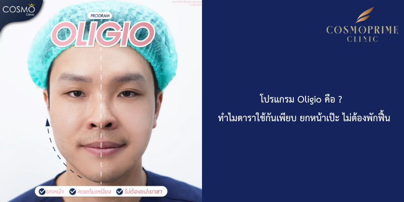 โปรแกรม Oligio คือ