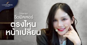 ฉีดฟิลเลอร์ตรงไหน