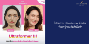 โปรแกรม Ultraformer ข้อเสีย