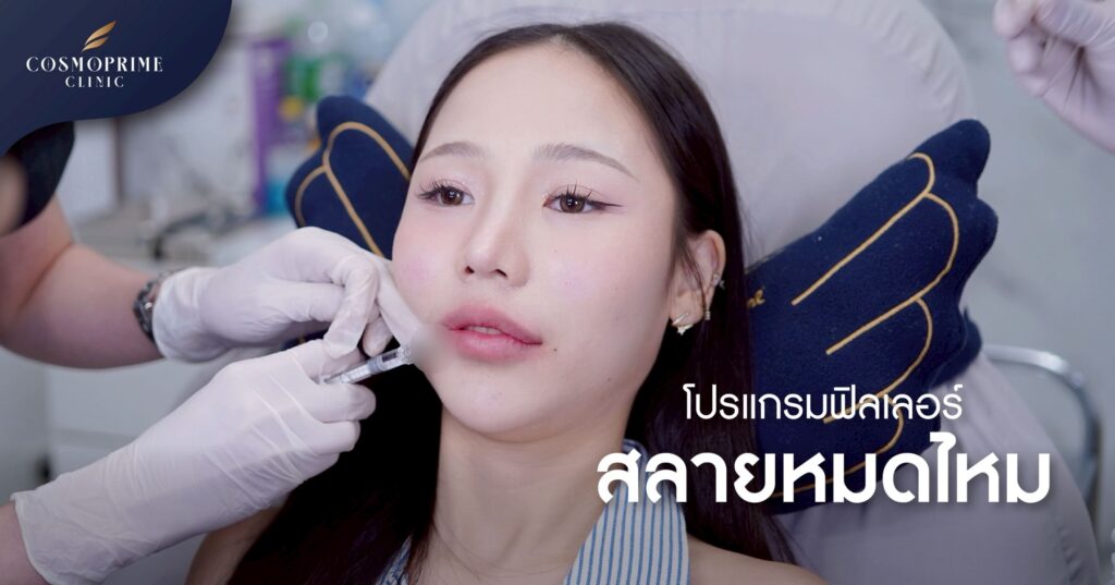 ฟิลเลอร์สลายหมดไหม