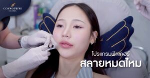 ฟิลเลอร์สลายหมดไหม