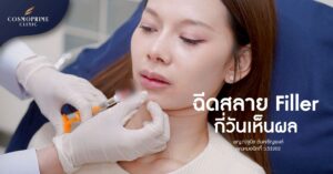 ฉีดสลาย filler กี่วันเห็นผล
